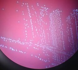 Aerococcus urinae - colonies.jpg
