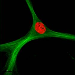 HMSC MAP4GFP H2BRFP.jpg