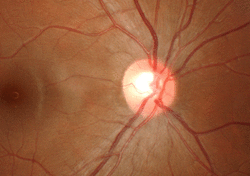 Optic cup and macula - 3D motion parallax.gif