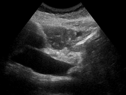 Ultrasound Scan ND 090551 0930550 cr.png
