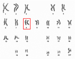 Human male karyotpe high resolution - Chromosome 8.png
