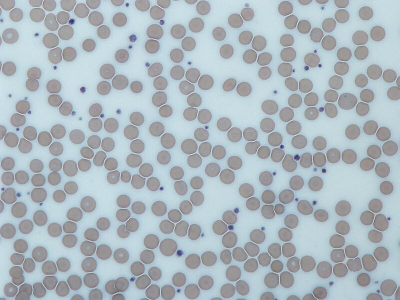 File:Platelets2.JPG