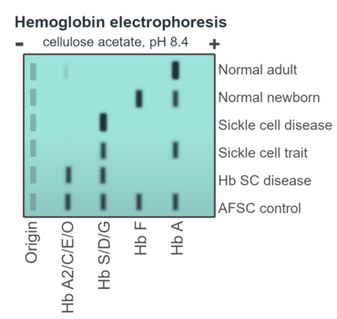 Schematic of alkaline hemoglobin electrophoresis.png