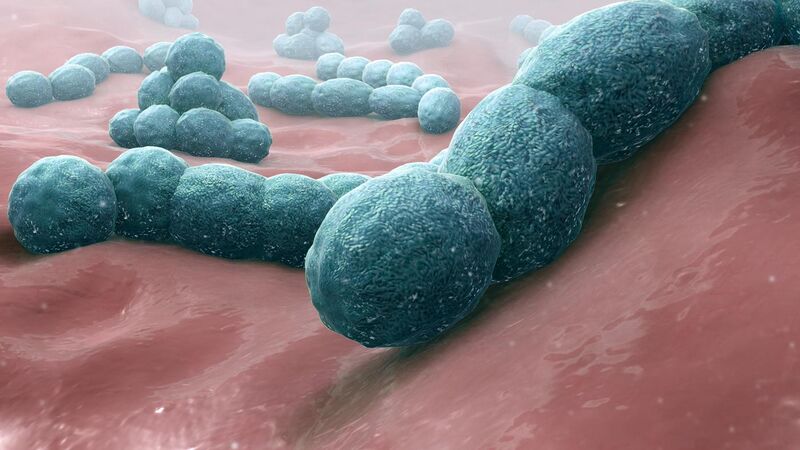 File:Streptococcus pneumoniae - A causative bacteria of meningitis.jpg