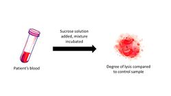 Sucrose lysis test.jpg