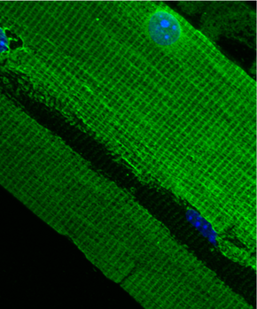 Costamere structure in mouse quadriceps - journal.pone.0002604.g003-cropped.png