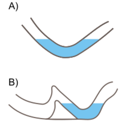 Two sectional diagrams illustrating the concept of a sump. Diagram "A" illustrates a U-shaped passage with water filling the rounded bottom section, blocking the dry passage either side. Diagram "B" shows a passage blocked similarly by a sump, but on one side the water level is being held back by a natural dam, with dry passage continuing beyond, below the water level of the sump.