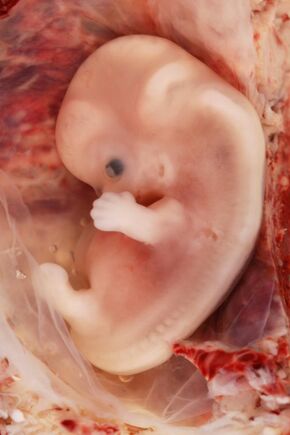 9-Week Human Embryo from Ectopic Pregnancy.jpg