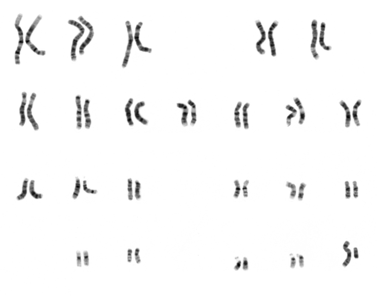 File:NHGRI human male karyotype.png