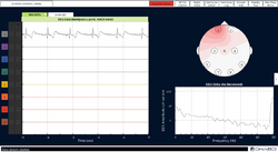 Screenshot of the OpenBCI Processing application displaying a basic electroencephalogram