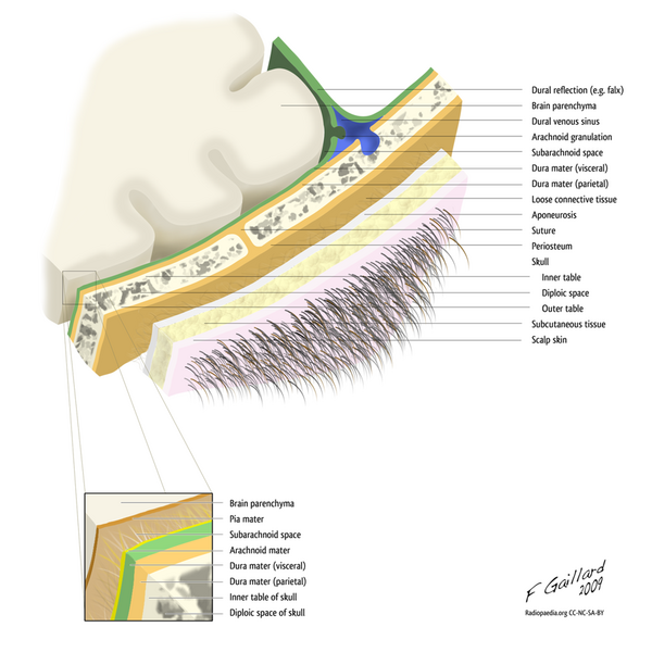 File:Layers of the scalp and meninges.png
