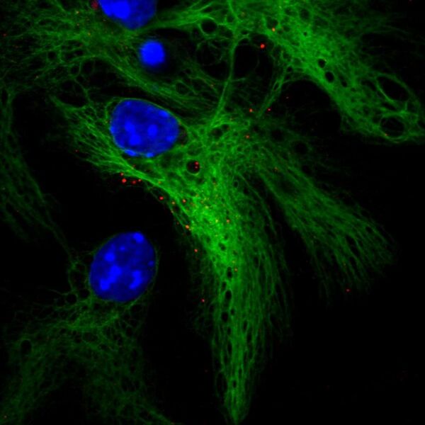File:Neural Stem Cells and Growth Hormone Receptor.jpg