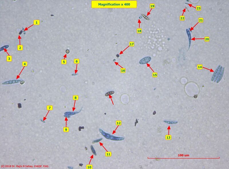 File:Some Airborne Fungal Spores.jpg