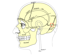 Medicine:Asterion (anatomy) - HandWiki