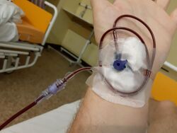 Picture of blood transfusion