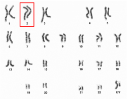 Human male karyotpe high resolution - Chromosome 2.png