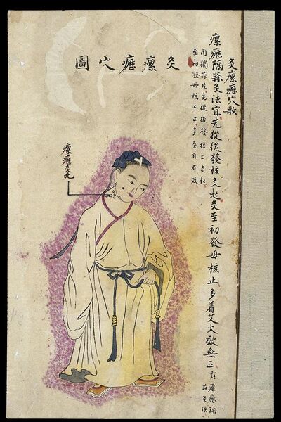 File:C19 Chinese MS moxibustion point chart; Scrofula point Wellcome L0039512.jpg