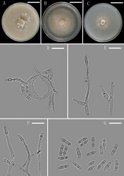 Plectosphaerella cucumerina (10.3897-mycokeys.80.64624) Figure 5.jpg