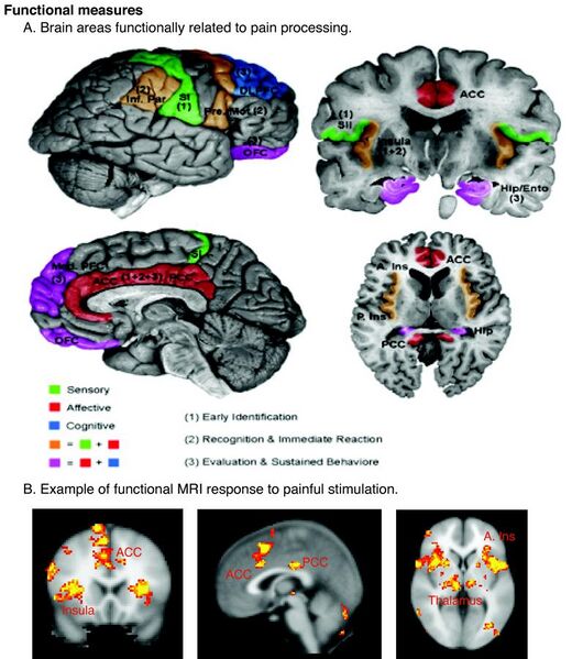 File:Schematic of cortical areas involved with pain processing and fMRI.jpg