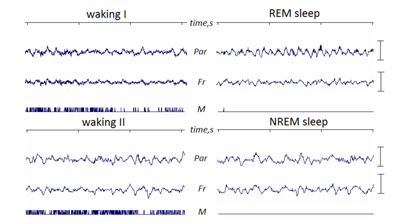 File:Normal EEG of mouse.png