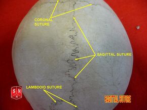 Sagittal suture 2.jpg
