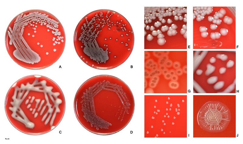 File:Escherichia coli on agar.jpg