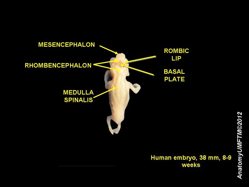 File:Human embryo 8 weeks 6.JPG