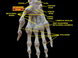 Slide1dsds - Scaphoid bone.png