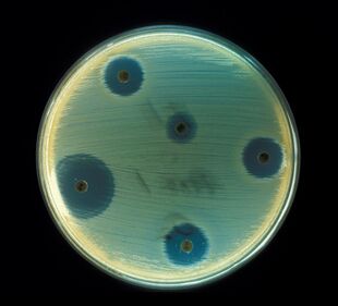 Staphylococcus aureus (AB Test).jpg