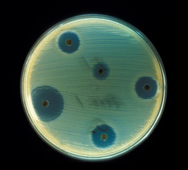 File:Staphylococcus aureus (AB Test).jpg