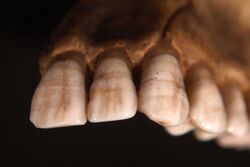 Teeth displaying Enamel hypoplasia lines.jpg