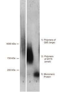 Example of a resulting western blott after SDD-AGE electrophoretic separation, staining by specific antibodies