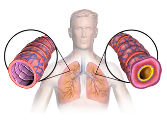 Asthma (Lungs).png