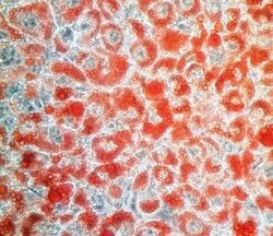 Differentiated 3T3-L1 Cell line stained with Oil O Red.jpg