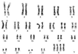 G-banded-chromosomal-analysis-showing-48-XXXX.jpg