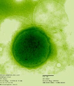 Thermococcus gammatolerans.jpg