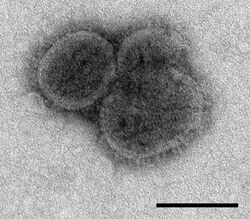 Electron micrograph of Bourbon virus (scale bar: 100 nm)