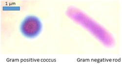 Gram positive coccus and gram negative rod.png