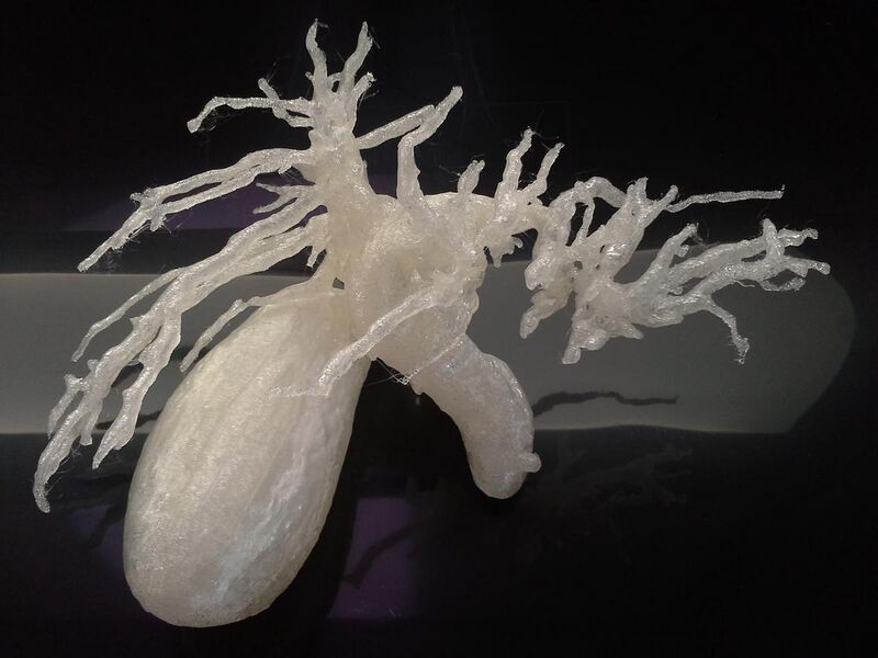 File:3DPrinted biliary system 20151201.jpg