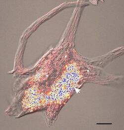 Lipofuscin neuro.jpg