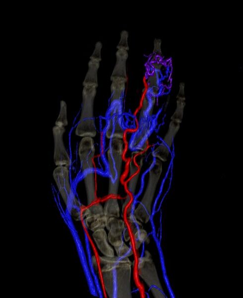 File:3D Picture of Hand.jpg