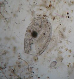 Micrograph of Bursaria ovata, a scoop-shaped ciliate