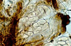 Placynthiella oligotropha-3.jpg