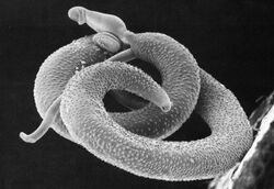 Schistosoma mansoni2.jpg
