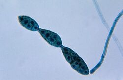 Chain of conidia of an Alternaria sp.