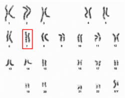 Human male karyotpe high resolution - Chromosome 7.png
