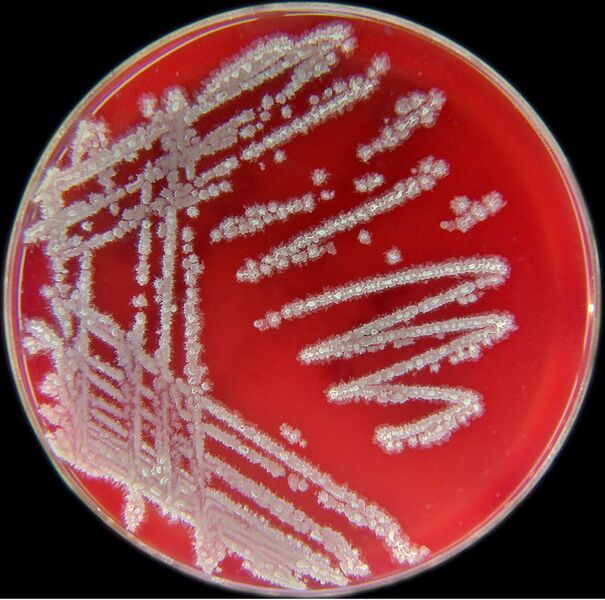 File:Bacillus licheniformis.jpg