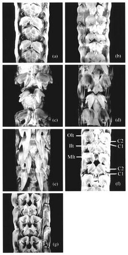 Different Limpet Teeth Structures.jpg