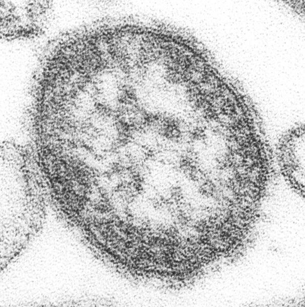 File:Measles virus.JPG