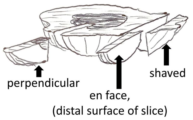 File:Perpendicular, en face and shaved slices.jpg